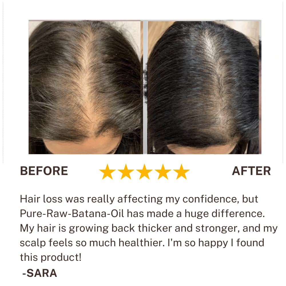 100% Pure Batana olie & shae butter! & coconut!  Super EFFECTIEF!